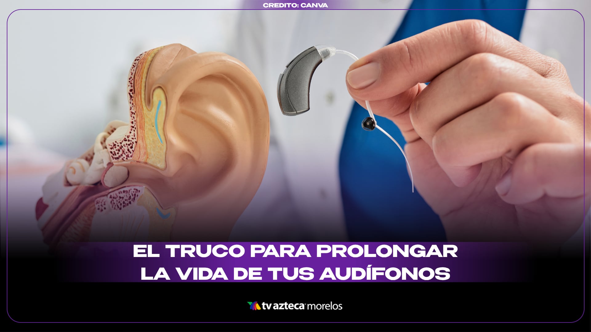 El truco para prolongar la vida de tus audífonos