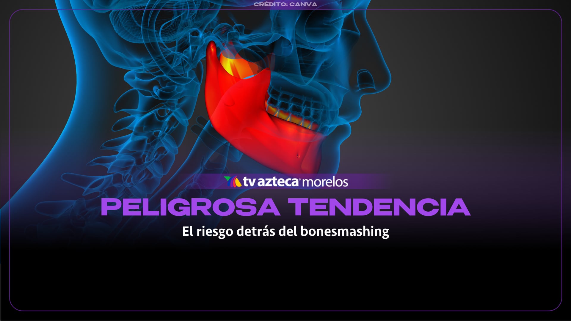 Imagen ilustrativa.