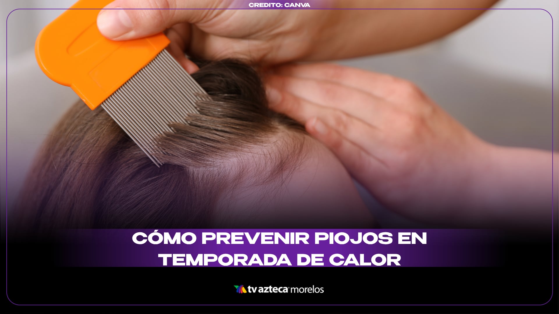 Cómo prevenir piojos en temporada de calor